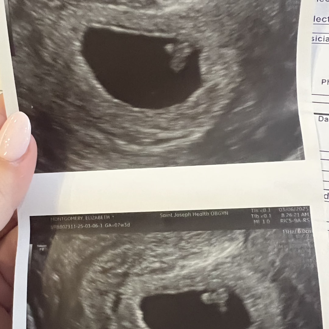 Photo shared by Lizzy for their Babylist baby registry.