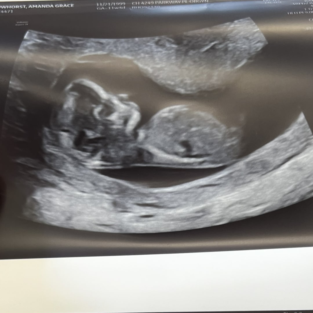 Photo shared by Amanda for their Babylist baby registry.