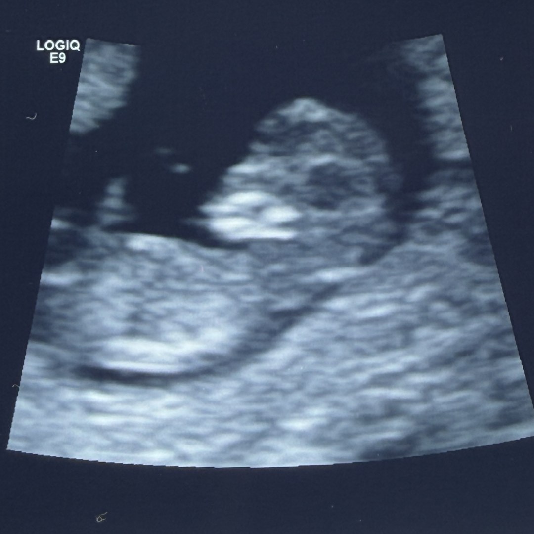 Photo shared by Alyssa for their Babylist baby registry.