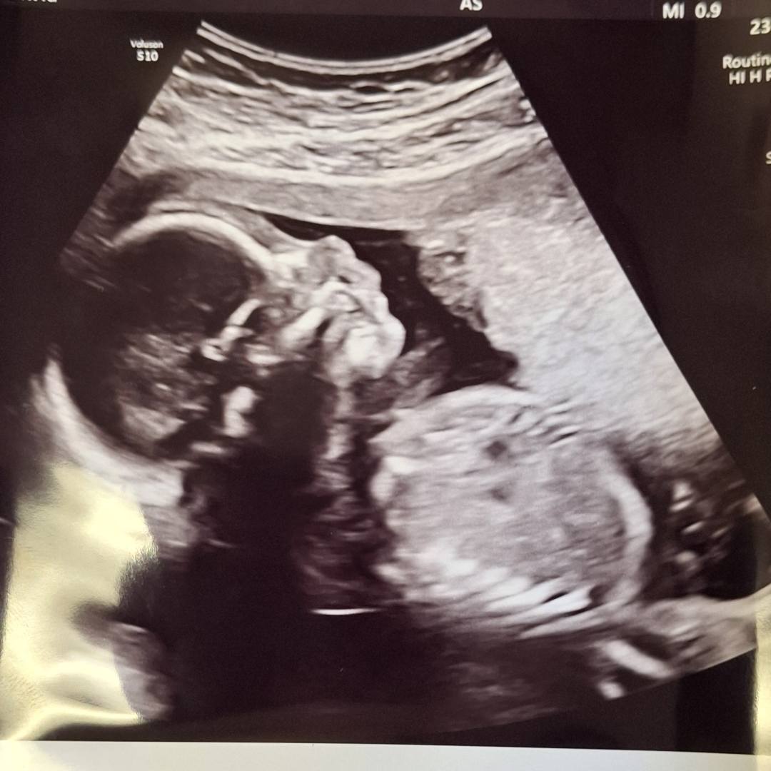 Photo shared by Abby for their Babylist baby registry.