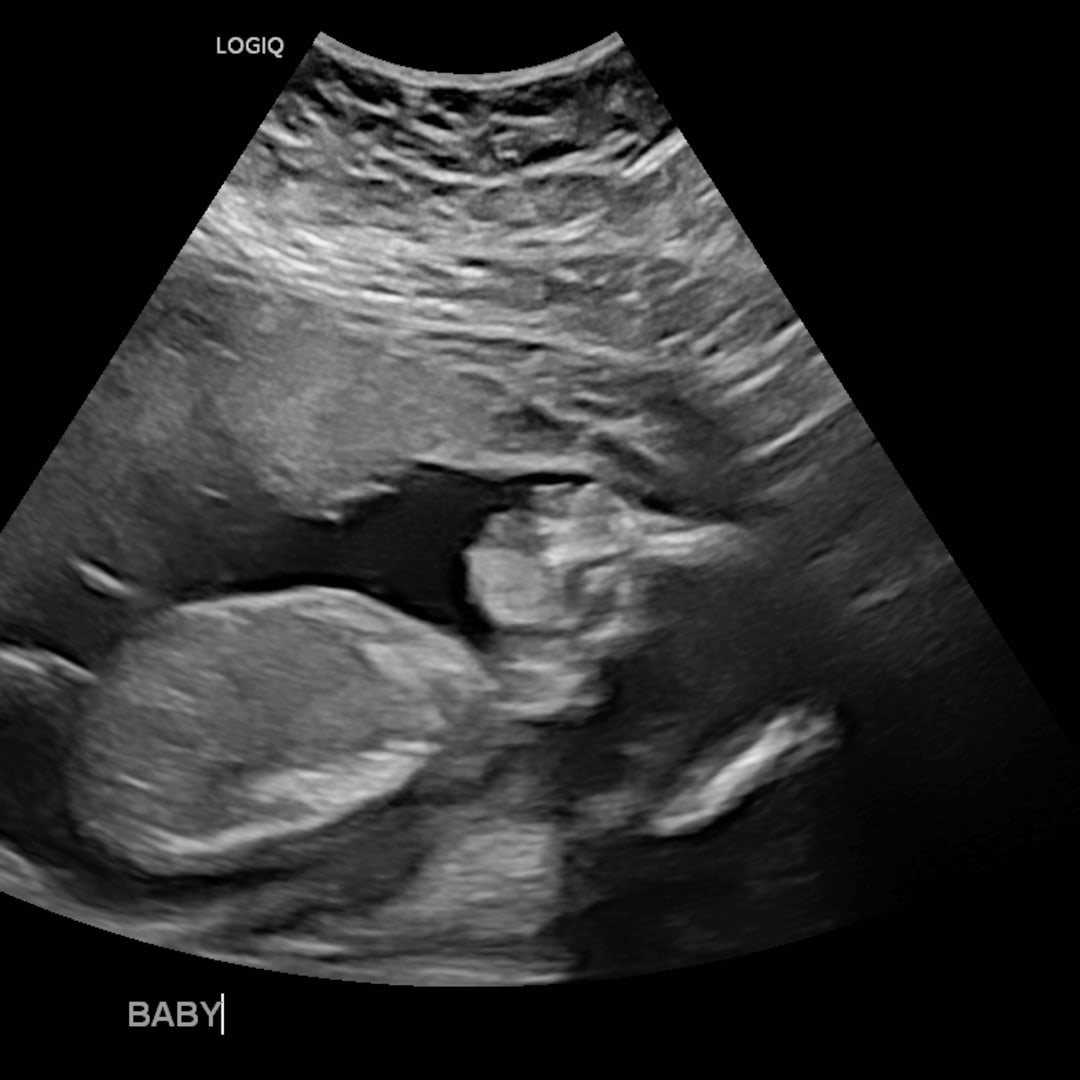 Photo shared by Sussie for their Babylist baby registry.