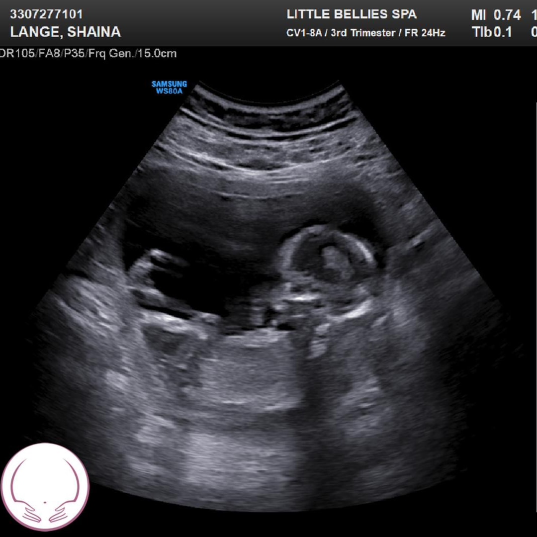 Photo shared by Shaina for their Babylist baby registry.