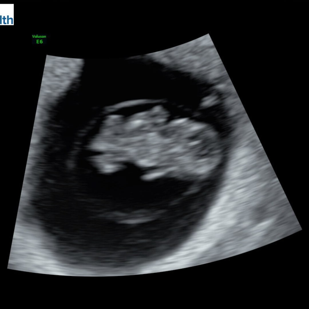 Photo shared by Eastlyn for their Babylist baby registry.