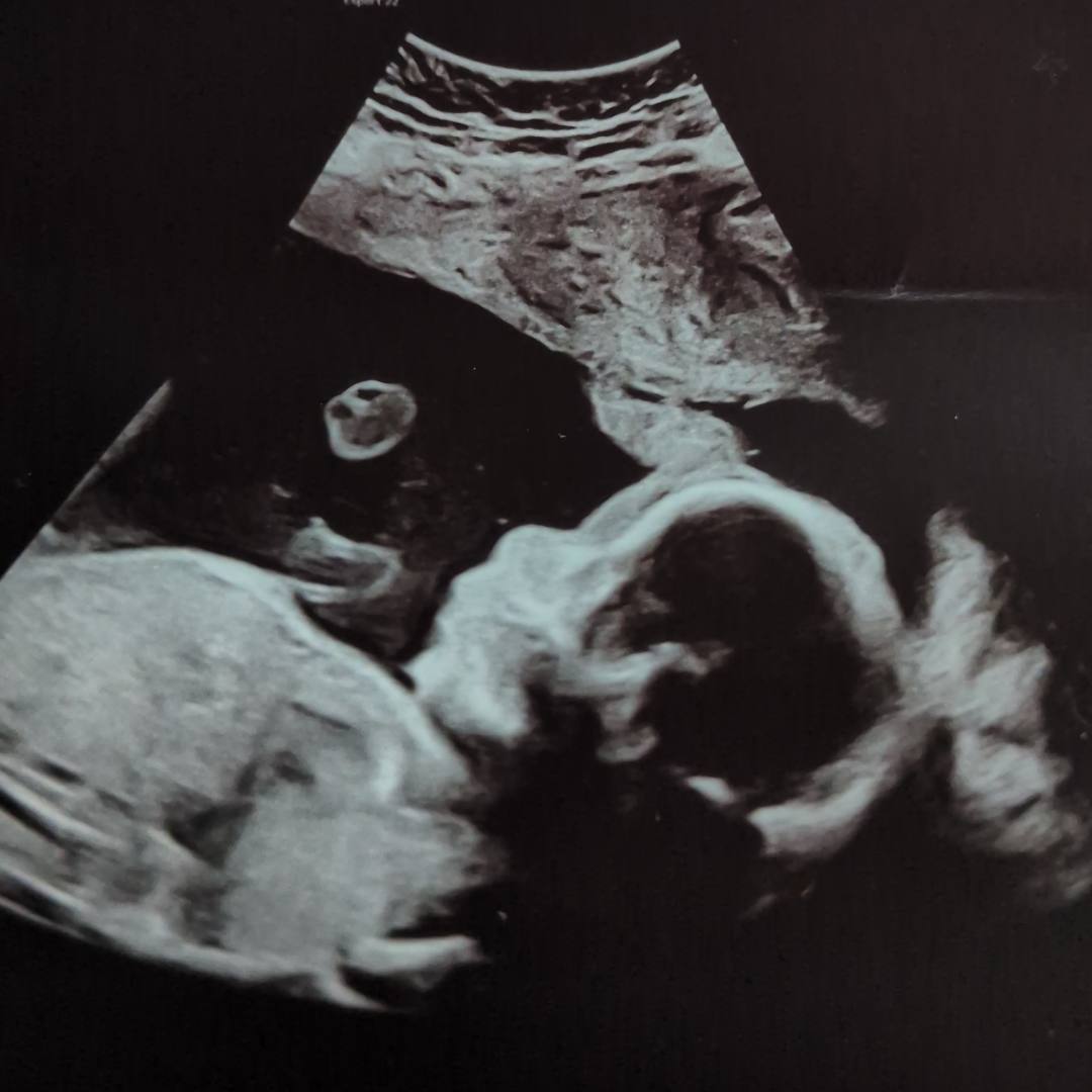 Photo shared by Katie for their Babylist baby registry.