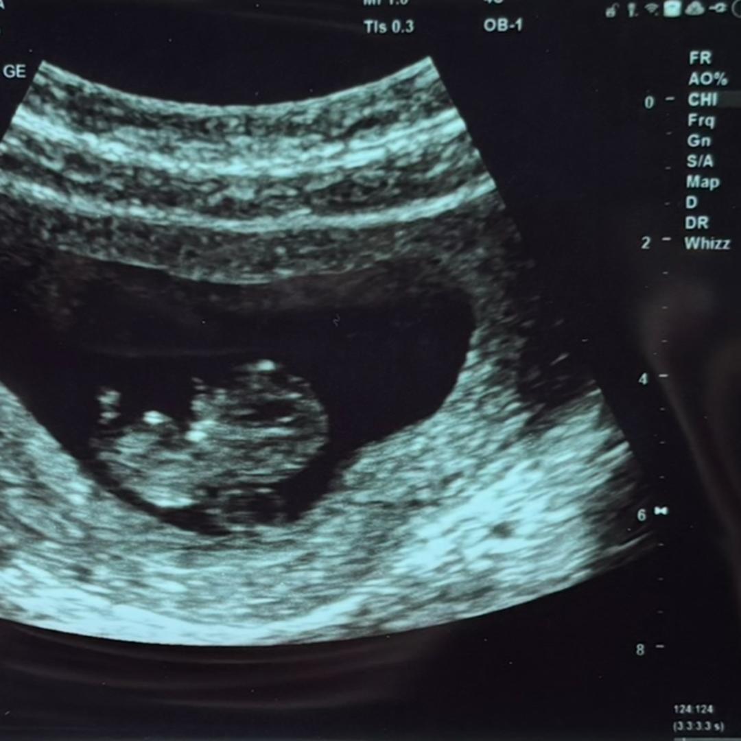 Photo shared by Summerlyn for their Babylist baby registry.