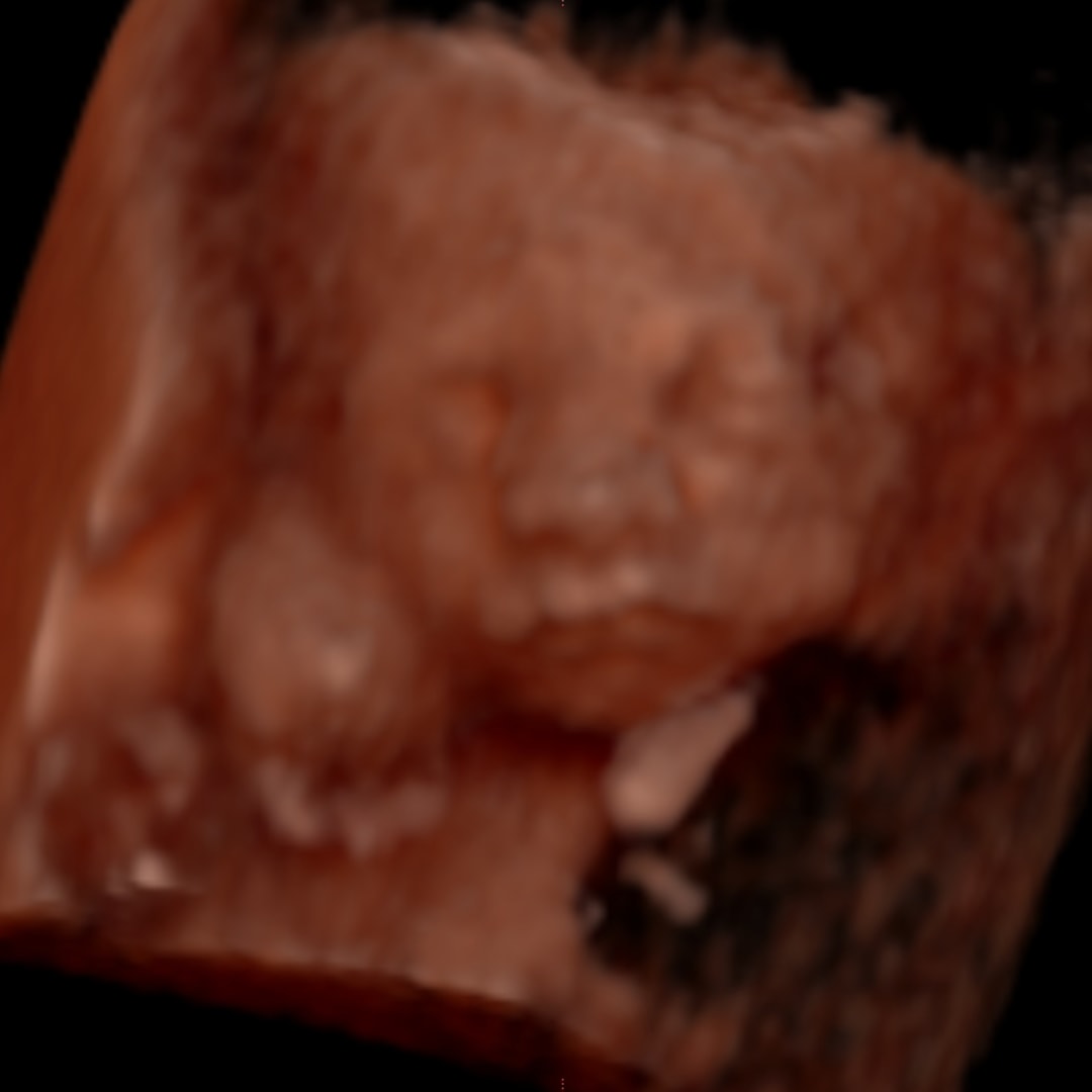 Photo shared by Ava for their Babylist baby registry.