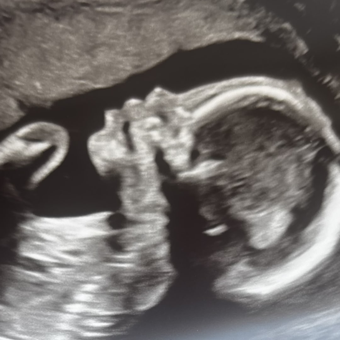 Photo shared by Skylar for their Babylist baby registry.