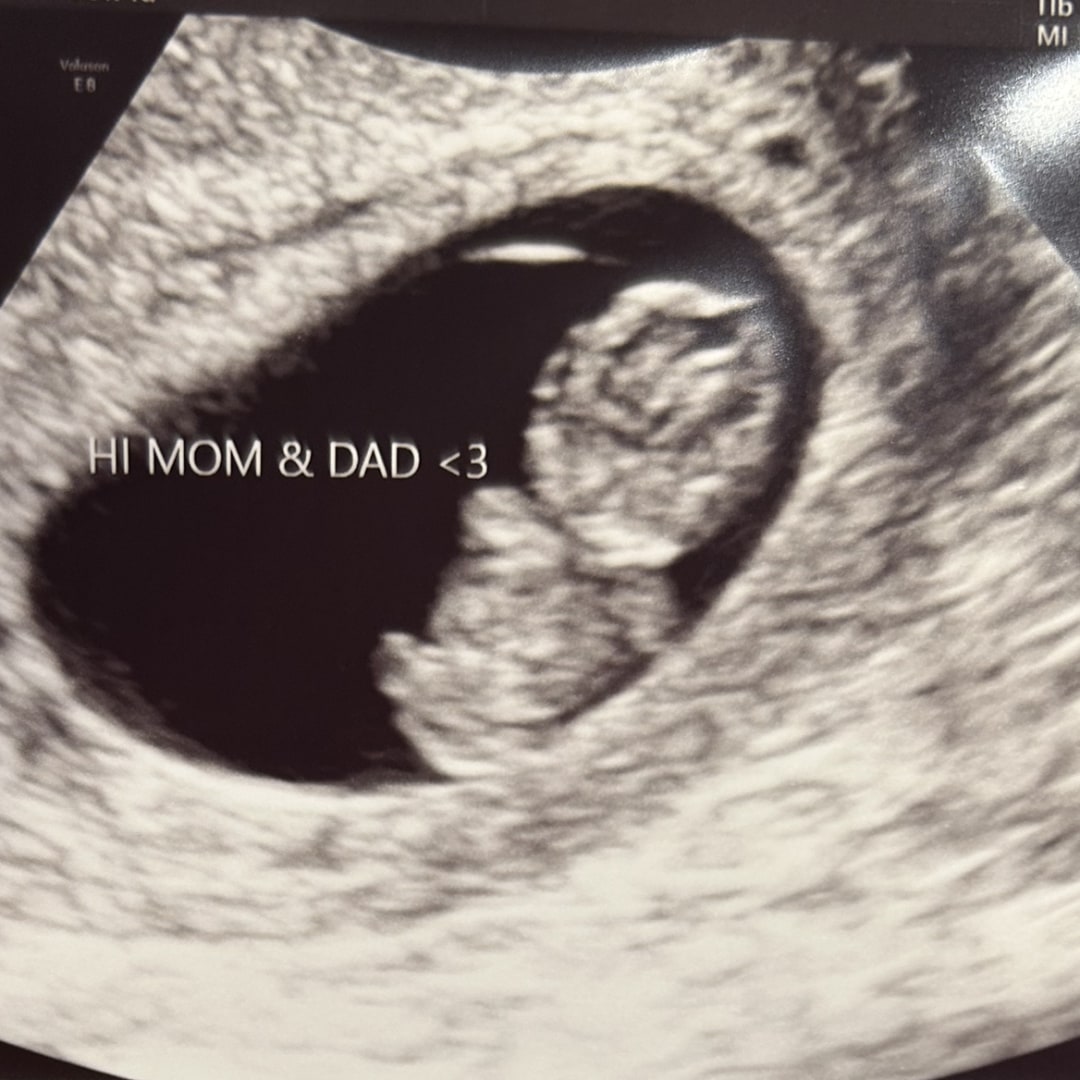 Photo shared by Lauren for their Babylist baby registry.