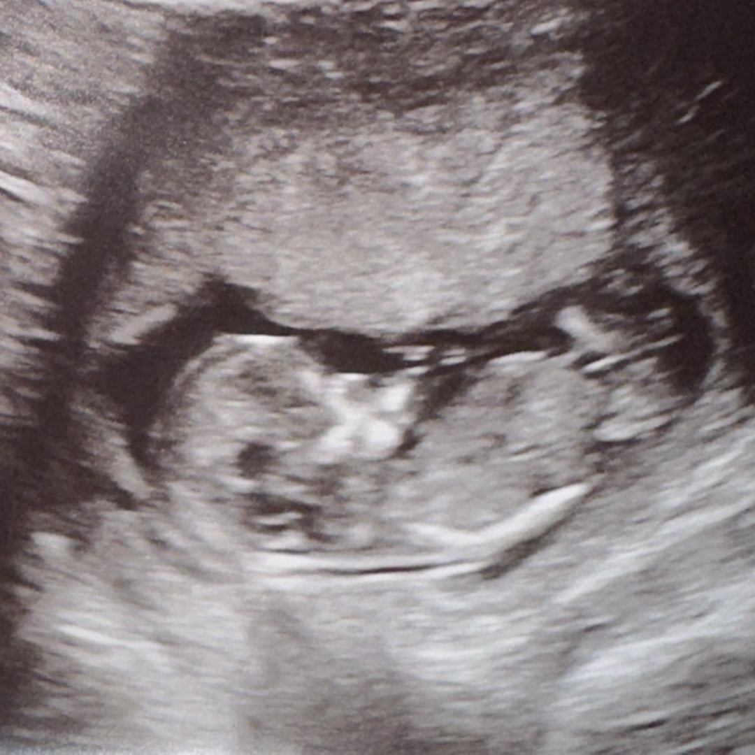 Photo shared by Faith for their Babylist baby registry.