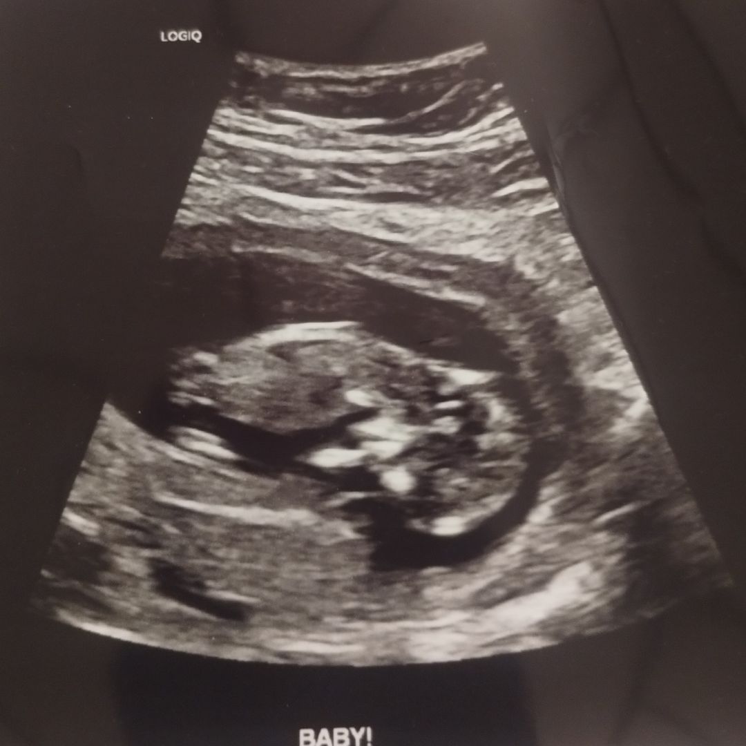 Photo shared by Ellie for their Babylist baby registry.