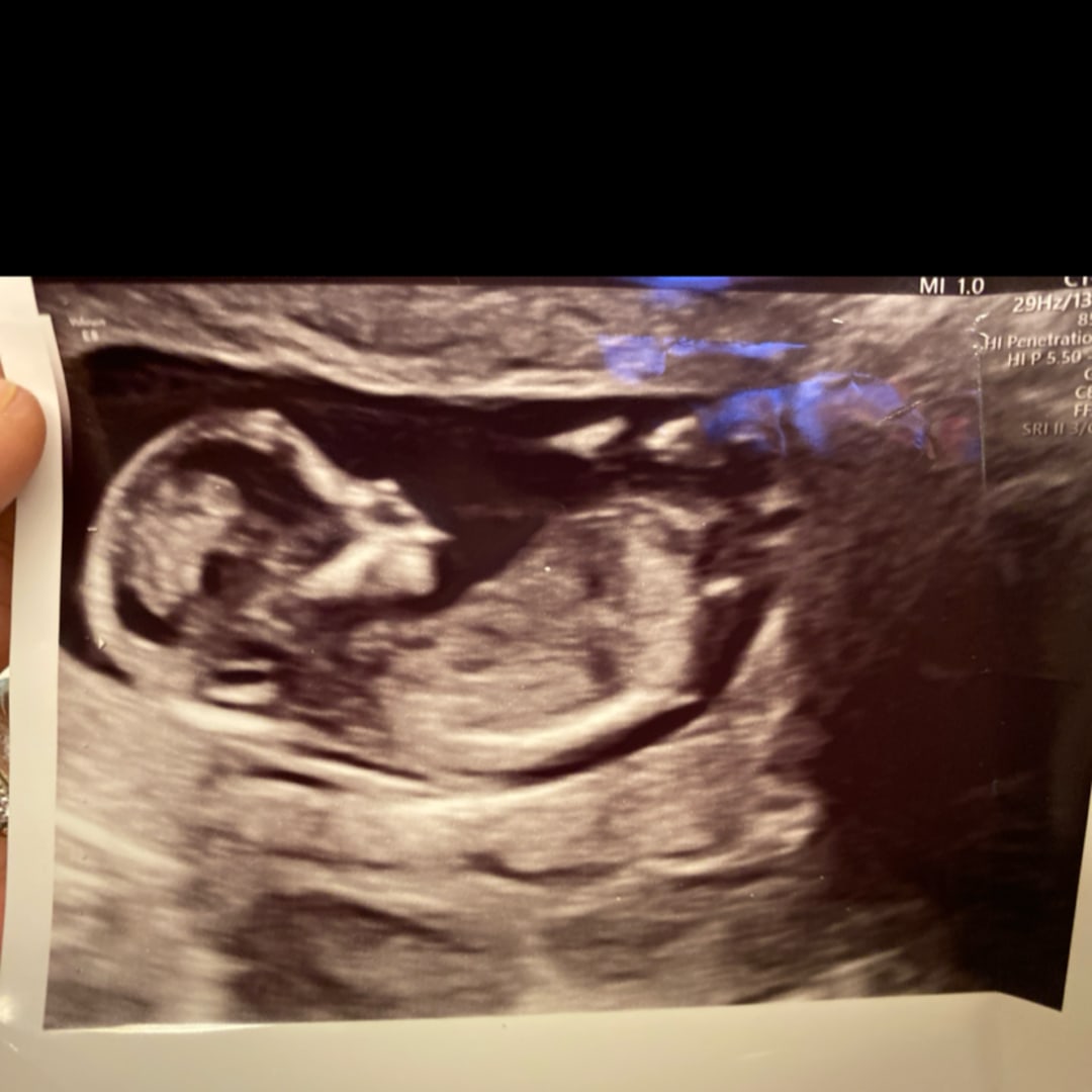 Photo shared by Destiny for their Babylist baby registry.