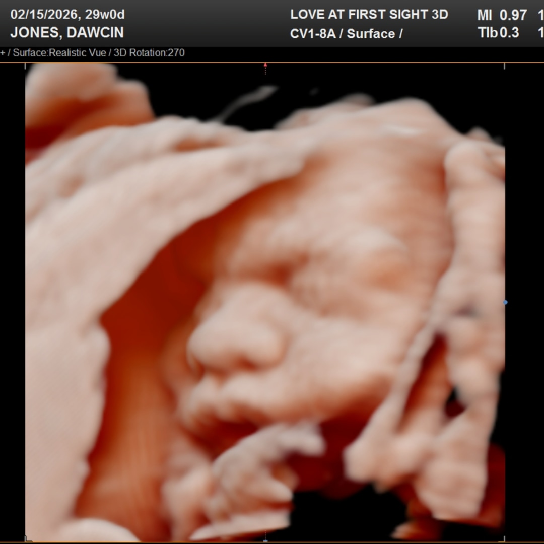 Photo shared by Dawcin for their Babylist baby registry.