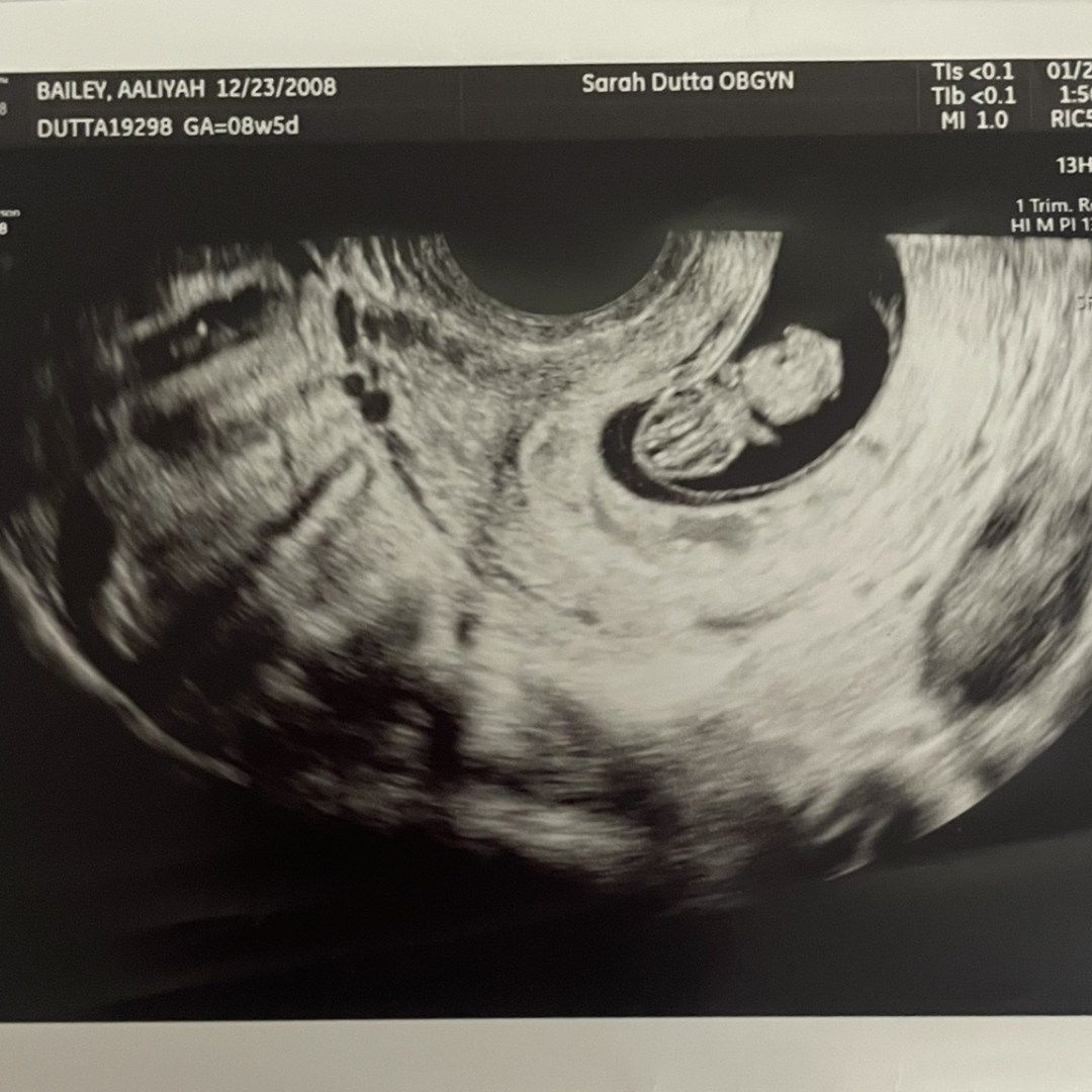 Photo shared by Aaliyah for their Babylist baby registry.