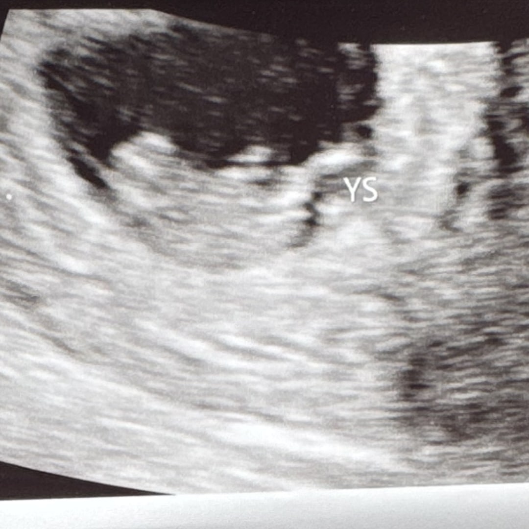 Photo shared by Jennifer for their Babylist baby registry.