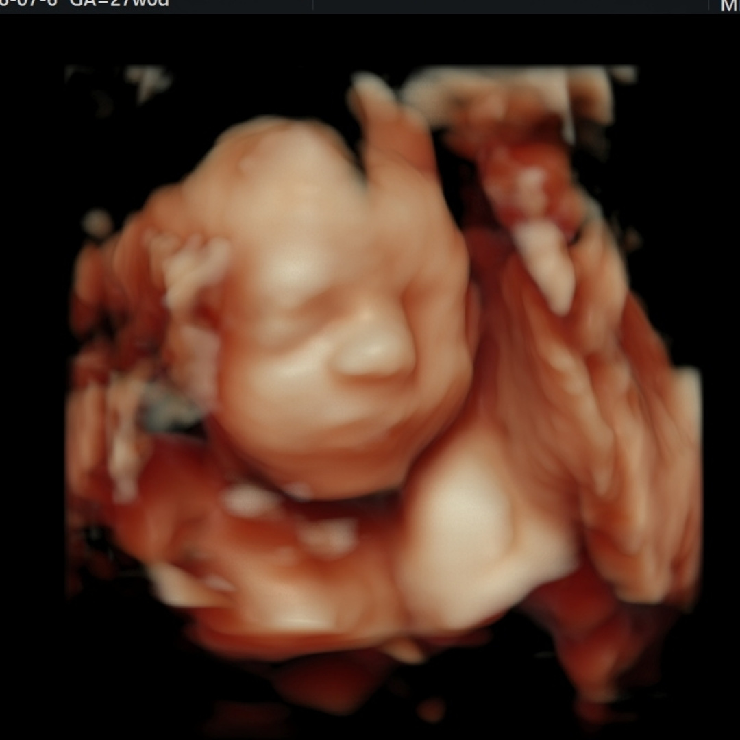 Photo shared by Cheyanne for their Babylist baby registry.