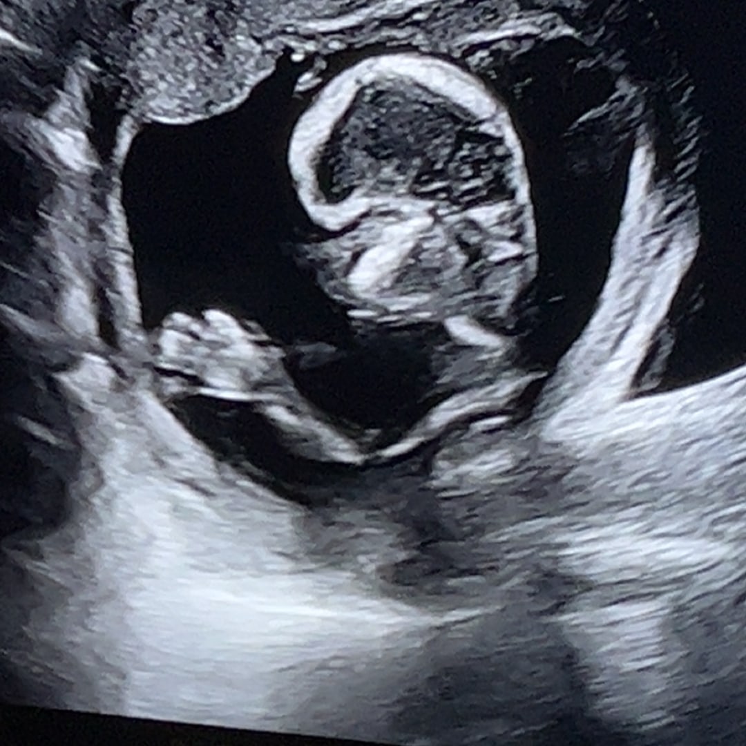 Photo shared by Harmony for their Babylist baby registry.