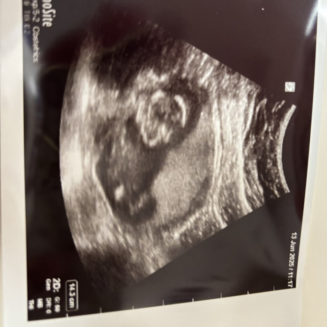 Photo shared by Corrisa for their Babylist baby registry.