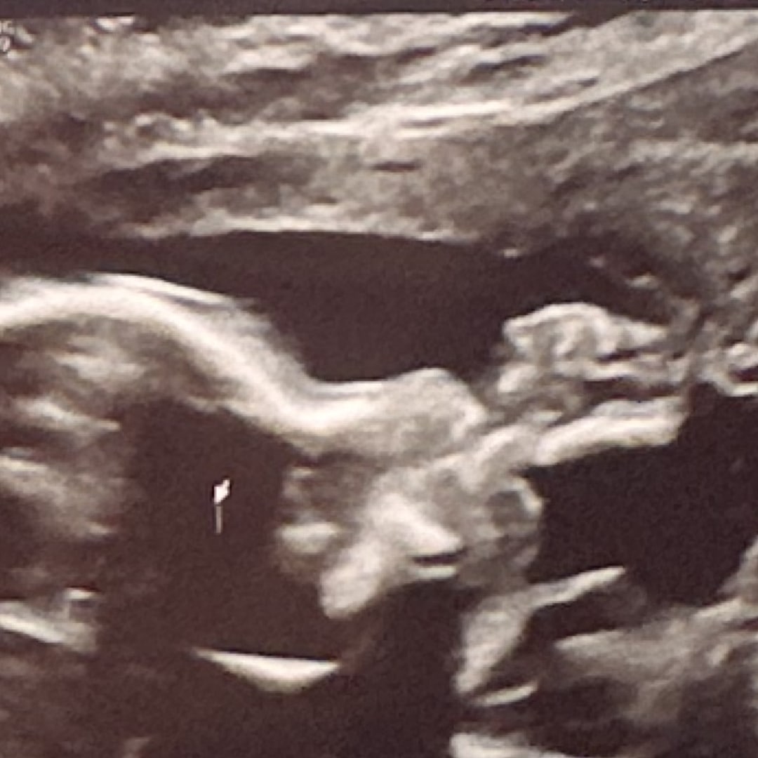 Photo shared by Katie for their Babylist baby registry.