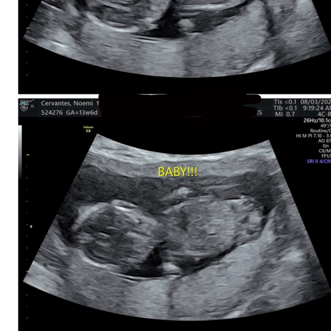 Photo shared by Noemi for their Babylist baby registry.