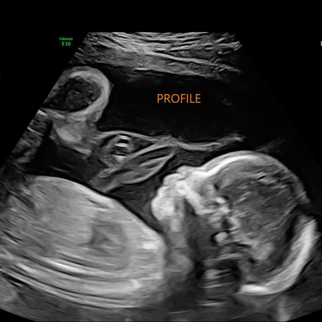 Photo shared by Arlyn for their Babylist baby registry.