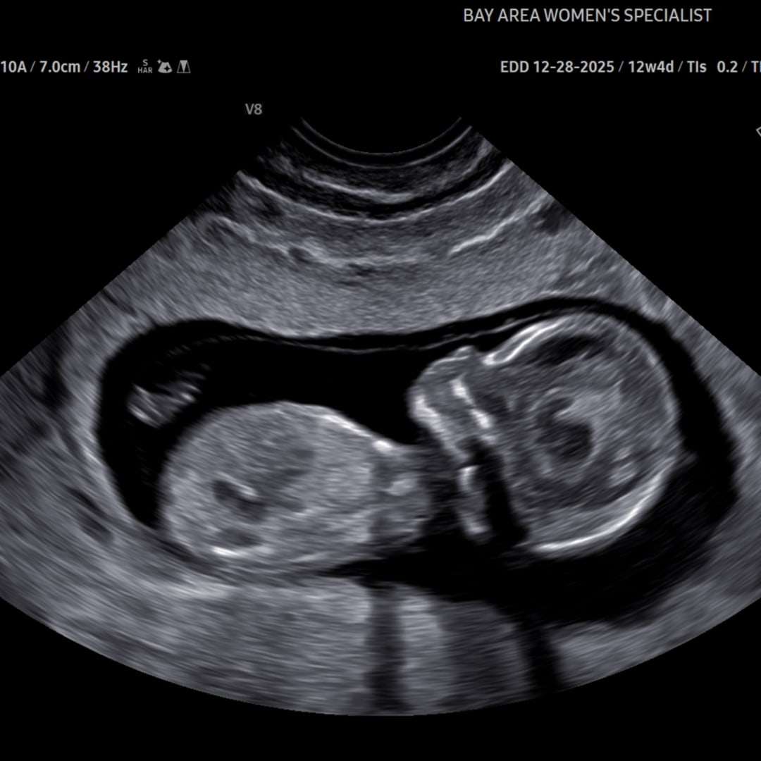 Photo shared by Alexis for their Babylist baby registry.