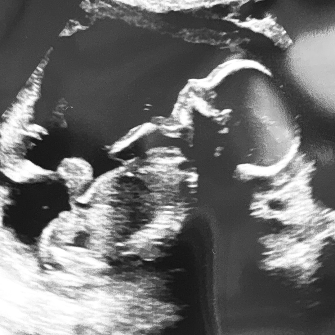 Photo shared by Kaylee for their Babylist baby registry.