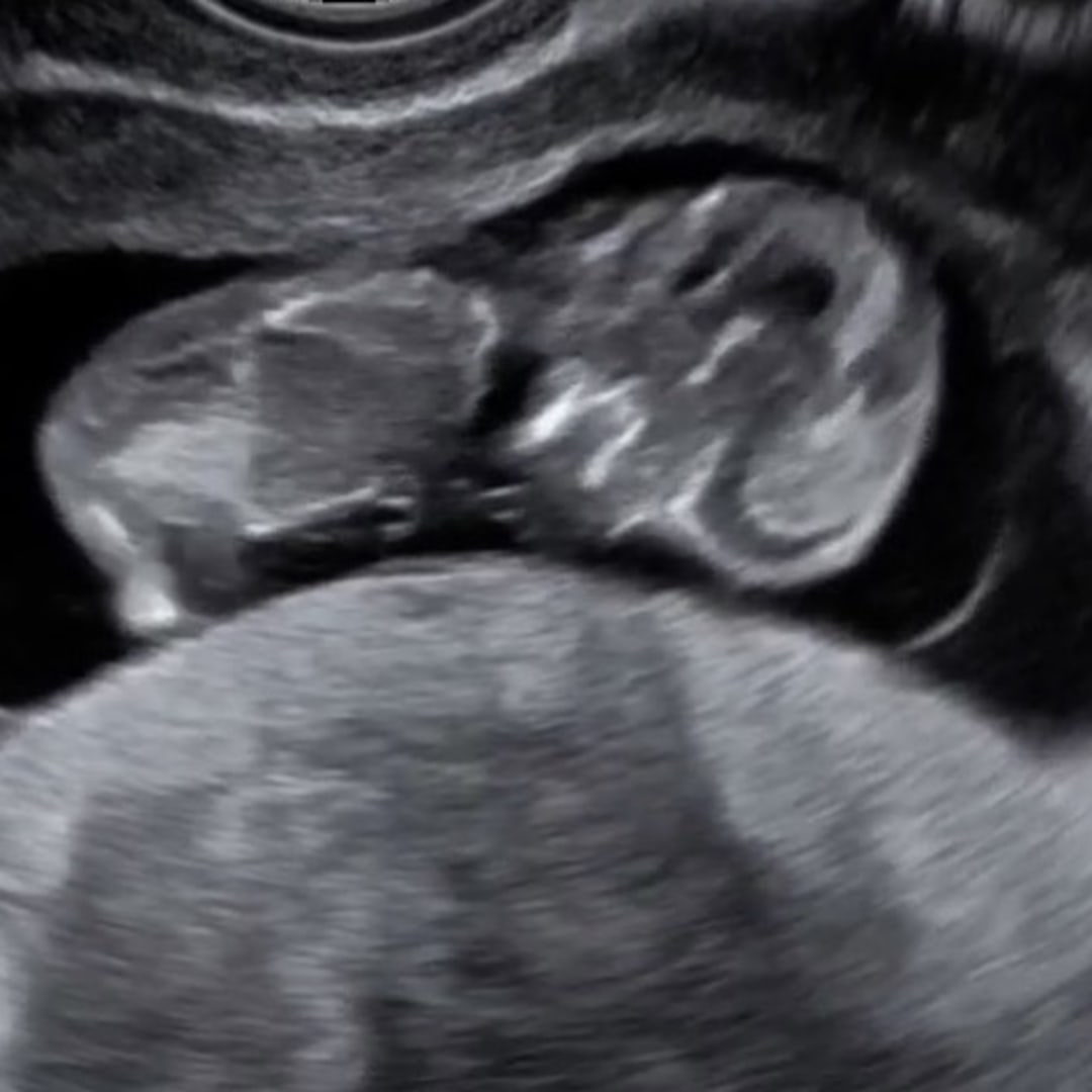 Photo shared by Skyler for their Babylist baby registry.