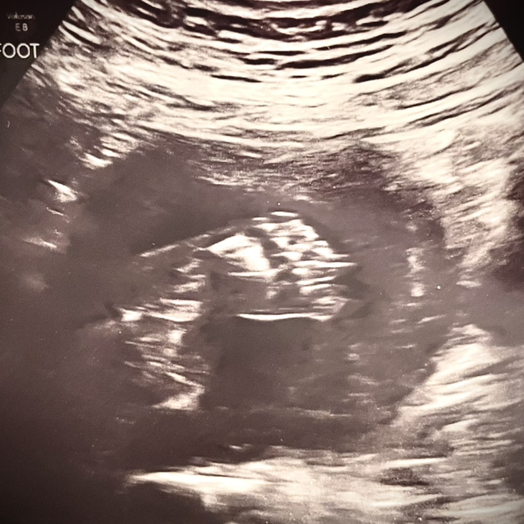 Photo shared by Jacqueline for their Babylist baby registry.