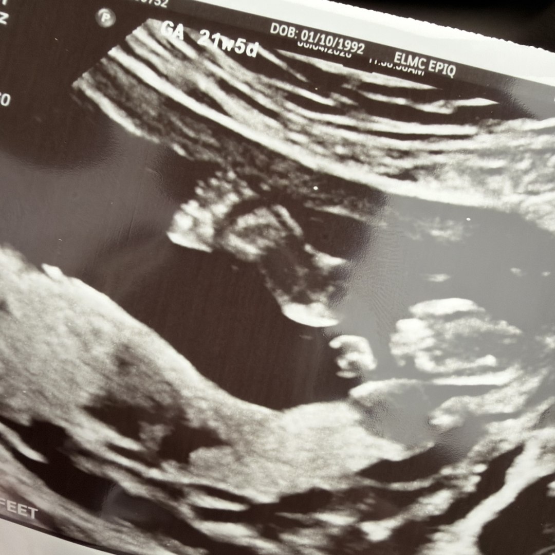 Photo shared by Marisa for their Babylist baby registry.