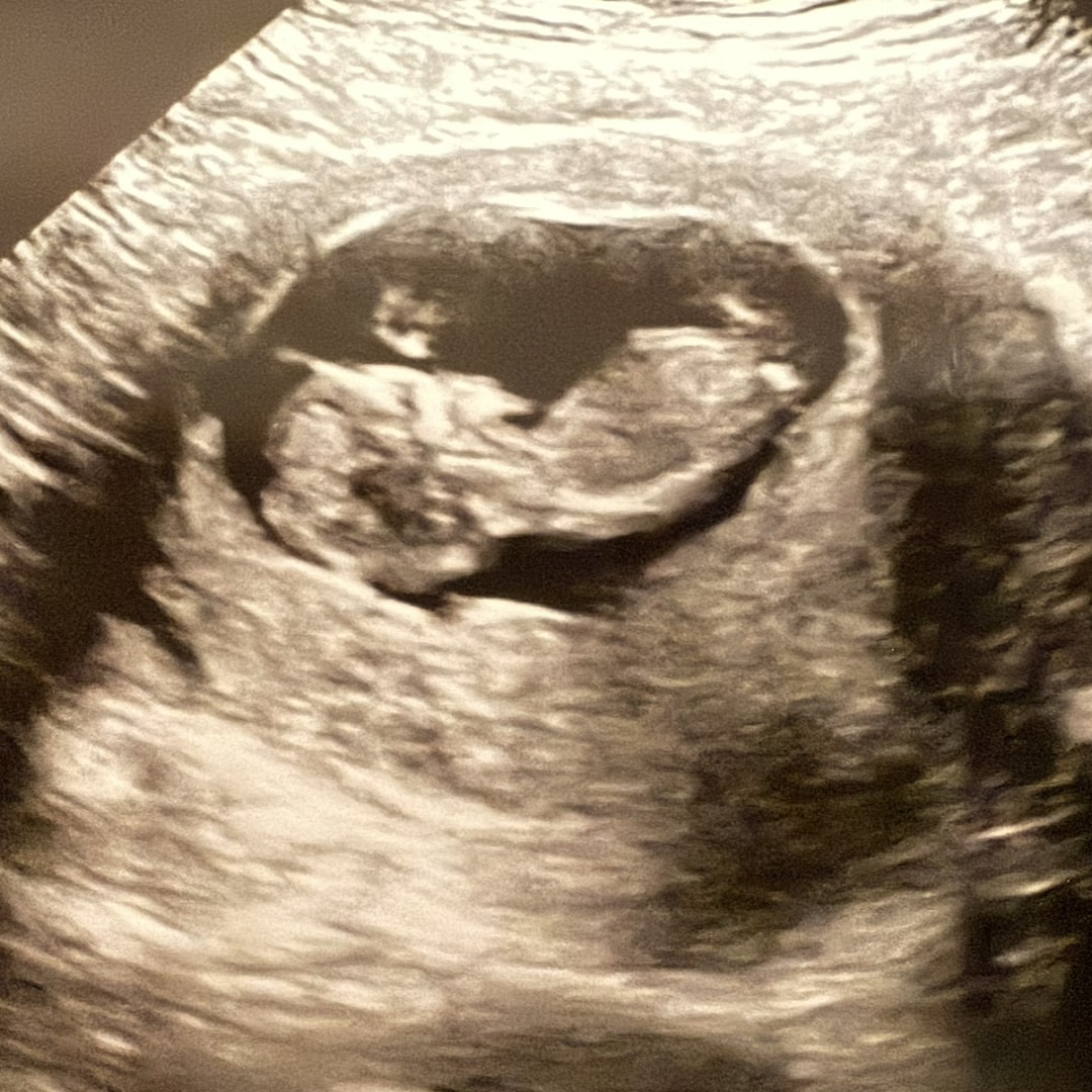 Photo shared by Estefania for their Babylist baby registry.