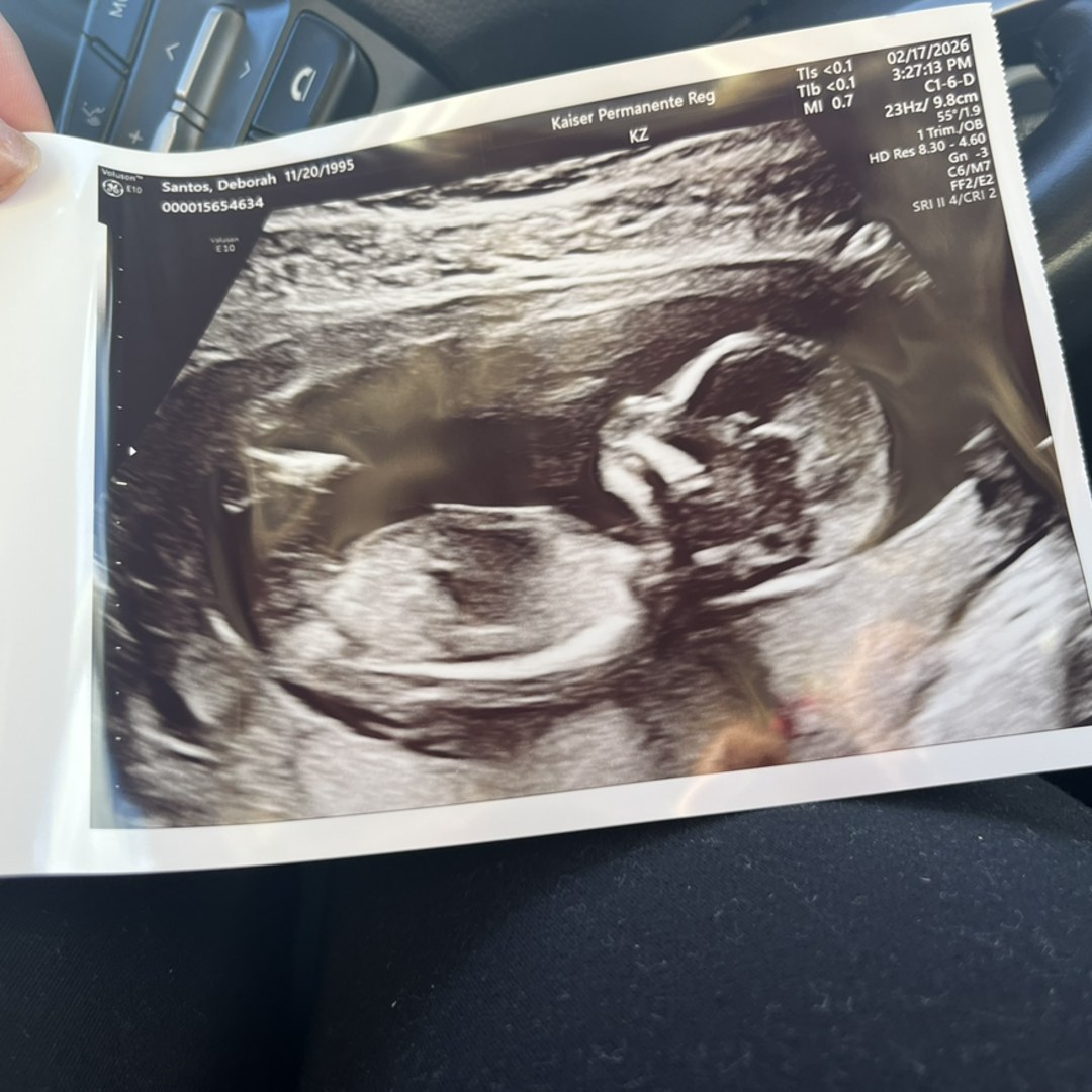 Photo shared by Deborah for their Babylist baby registry.