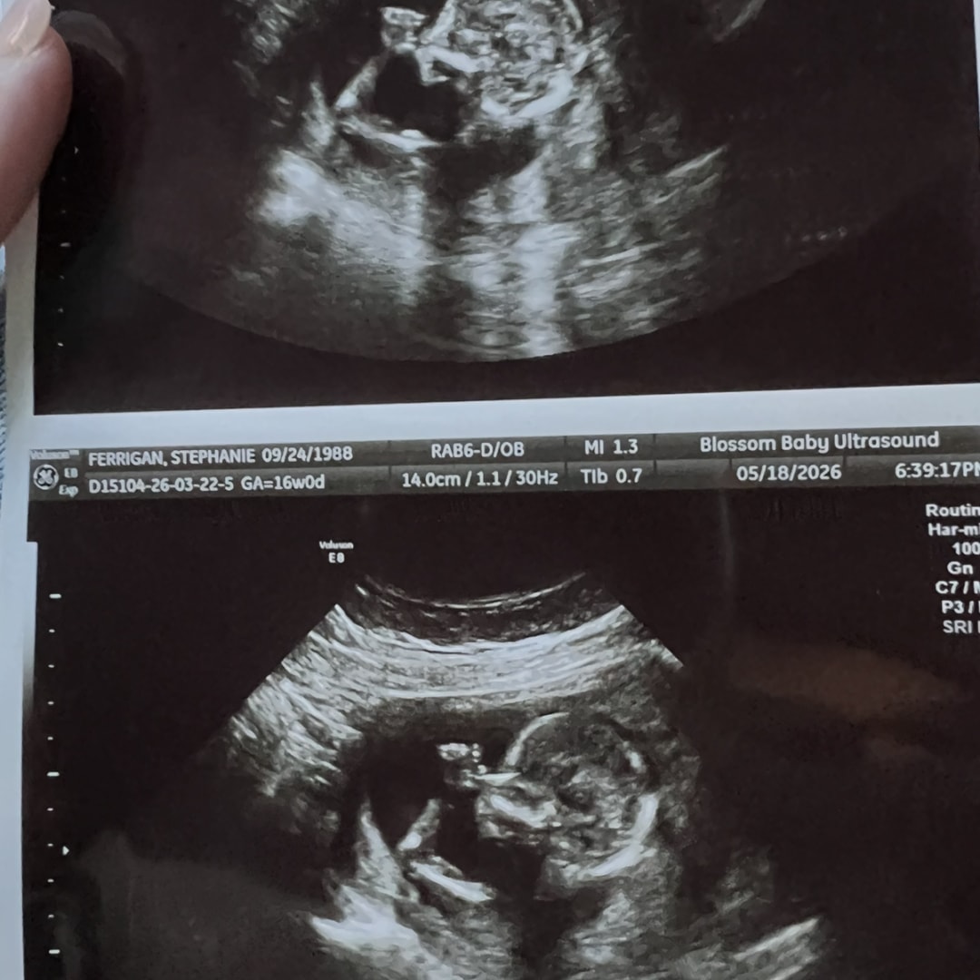 Photo shared by Stephanie for their Babylist baby registry.
