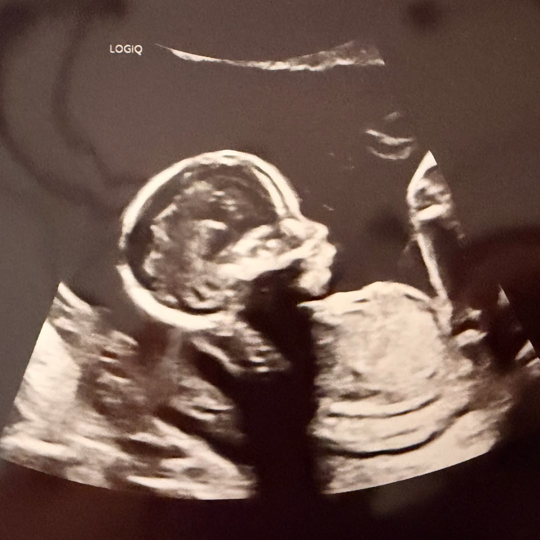 Photo shared by Sarah for their Babylist baby registry.