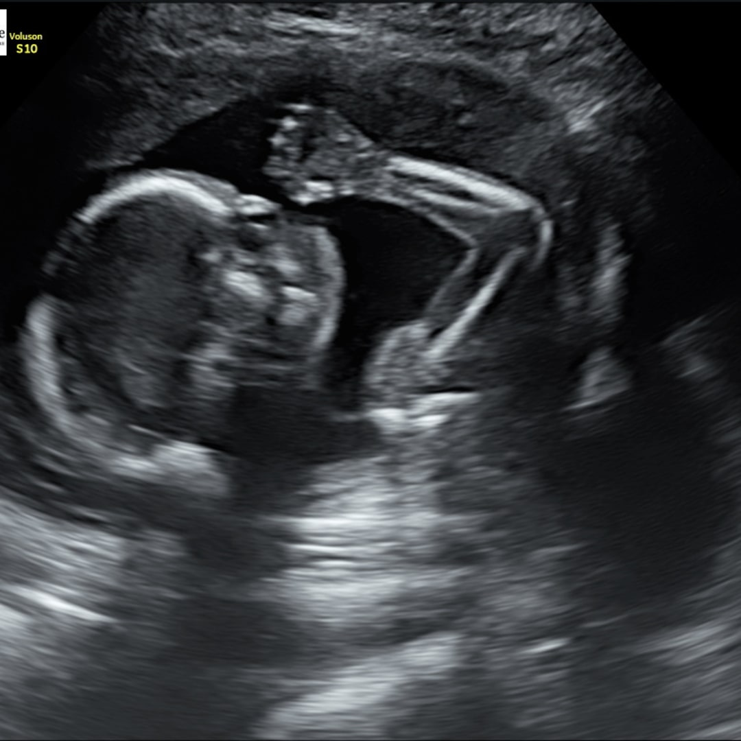 Photo shared by Dana for their Babylist baby registry.
