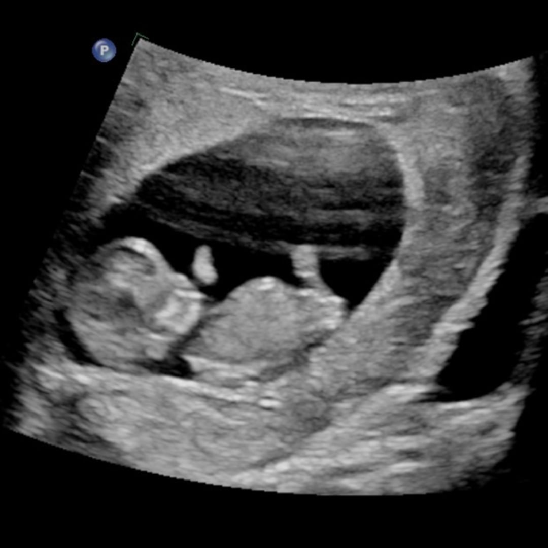Photo shared by Megan for their Babylist baby registry.