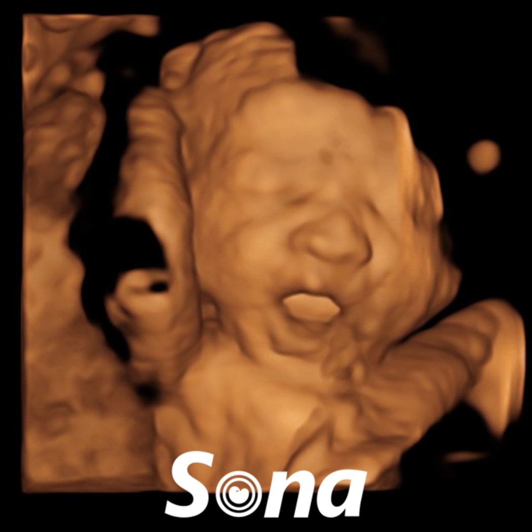 Photo shared by Ave for their Babylist baby registry.