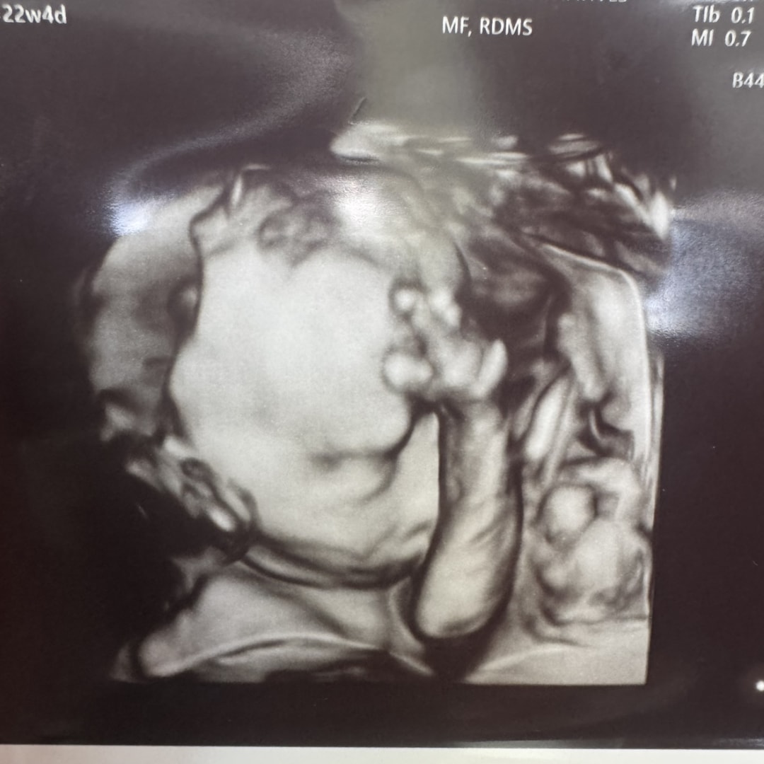 Photo shared by Taylor & for their Babylist baby registry.