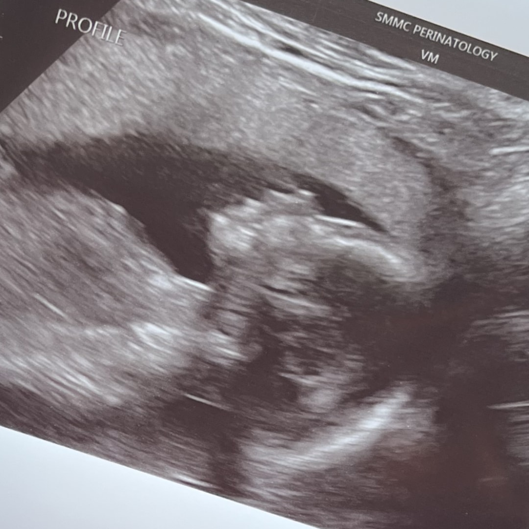 Photo shared by Carley for their Babylist baby registry.
