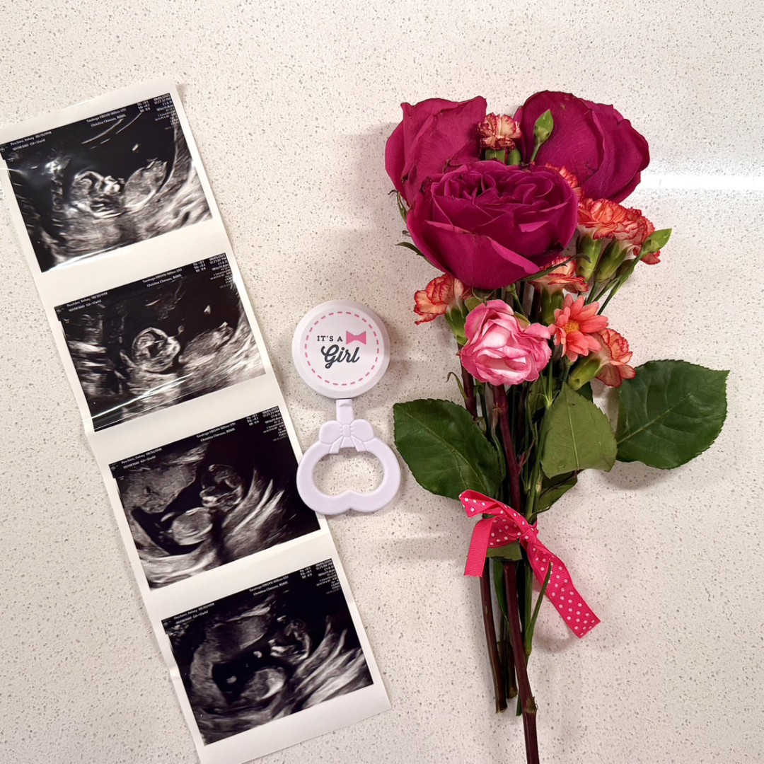 Photo shared by Kelsey for their Babylist baby registry.