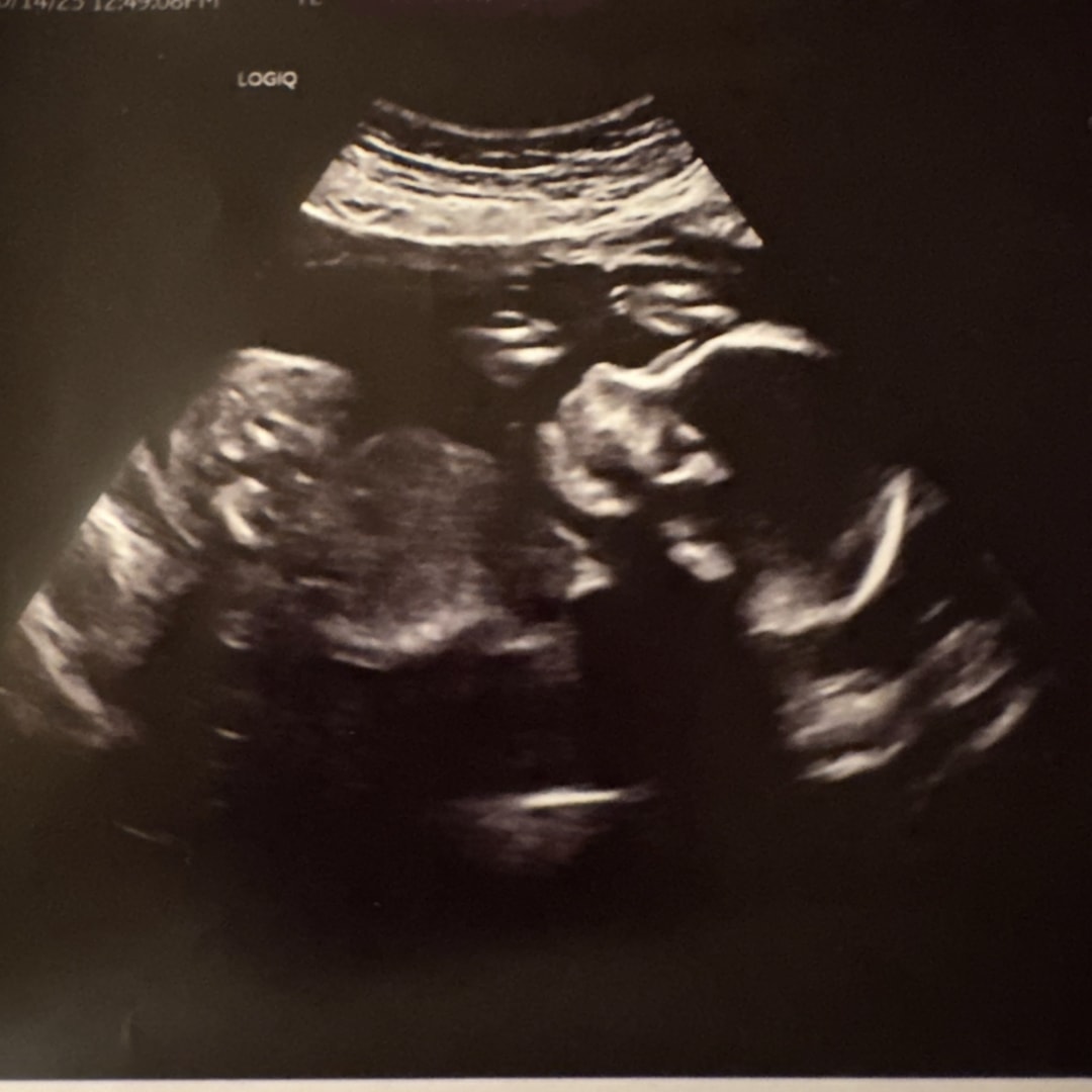 Photo shared by Priscilla for their Babylist baby registry.