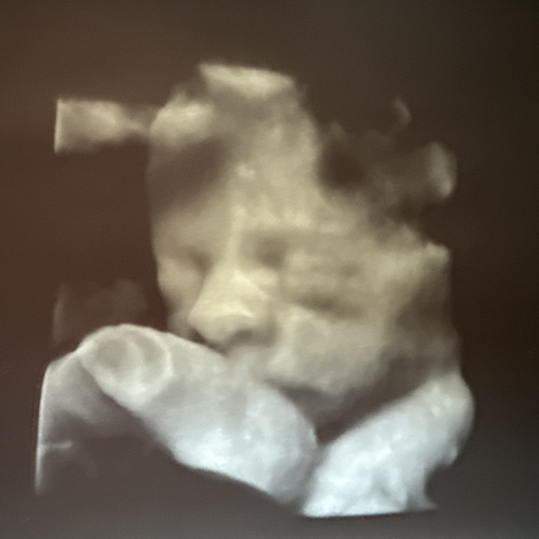 Photo shared by Patrick for their Babylist baby registry.