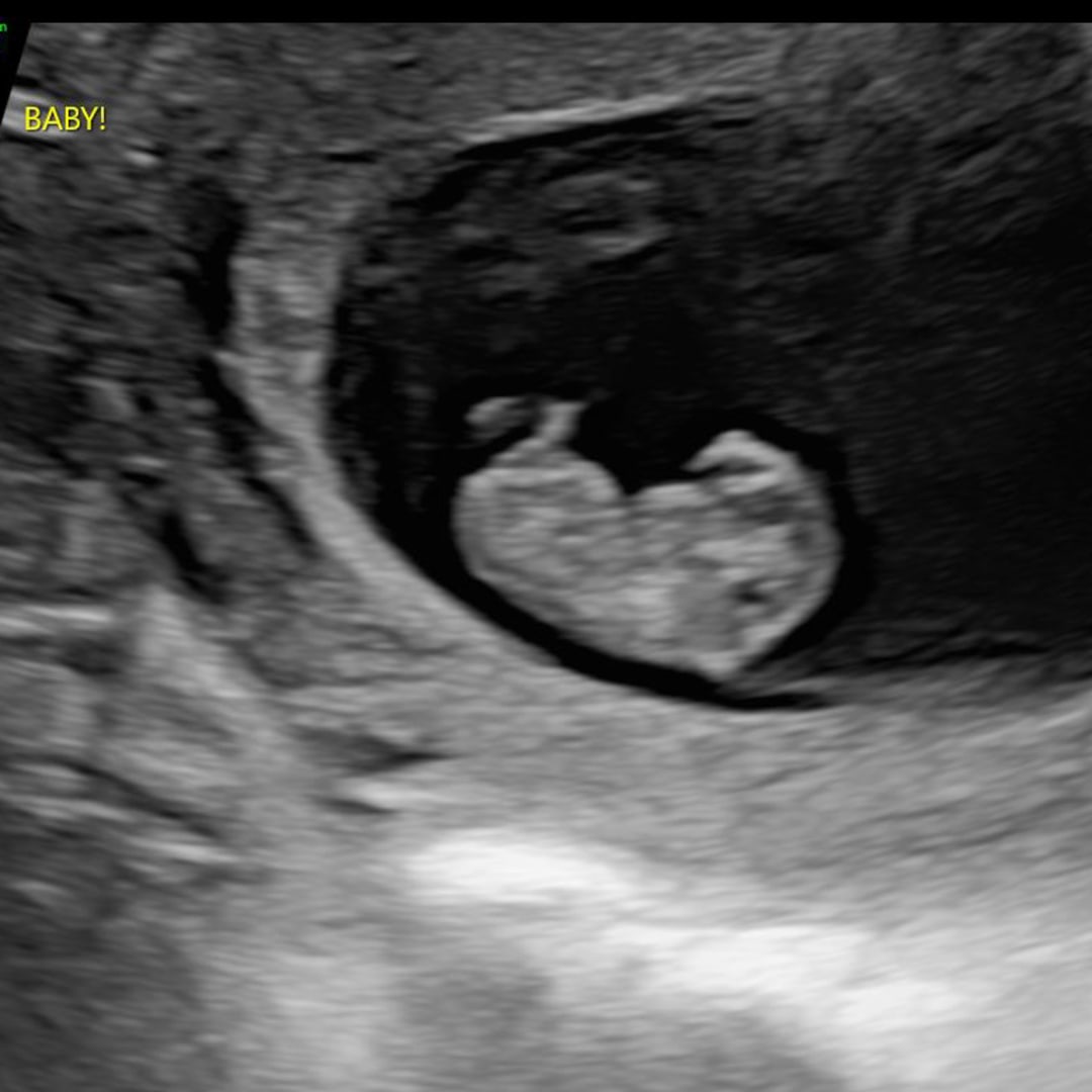 Photo shared by Kiara for their Babylist baby registry.