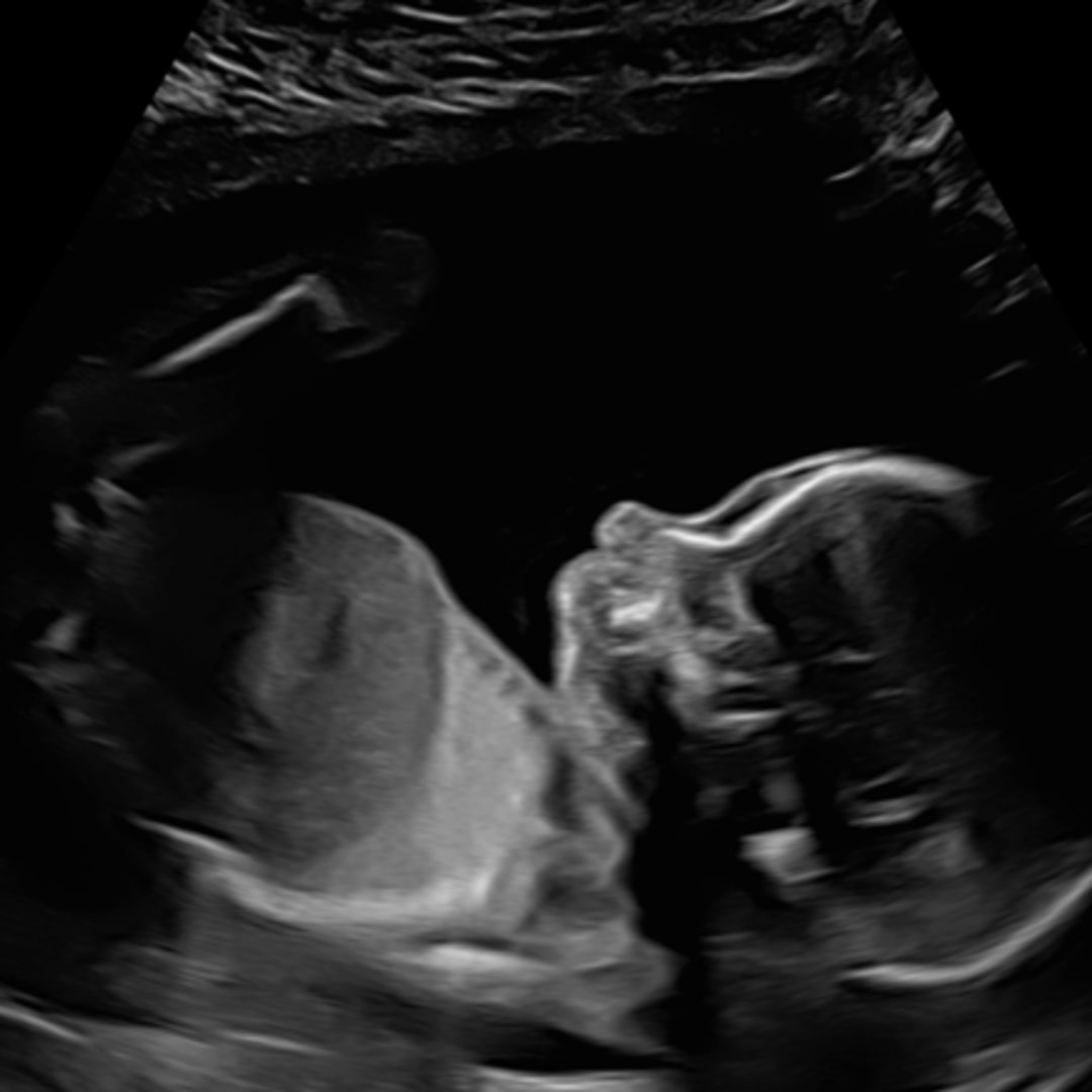 Photo shared by Elizabeth for their Babylist baby registry.