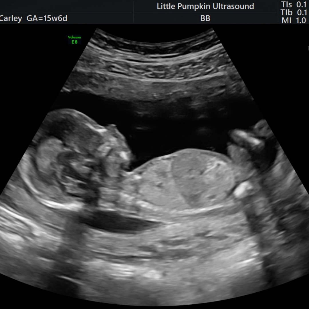 Photo shared by Carley for their Babylist baby registry.