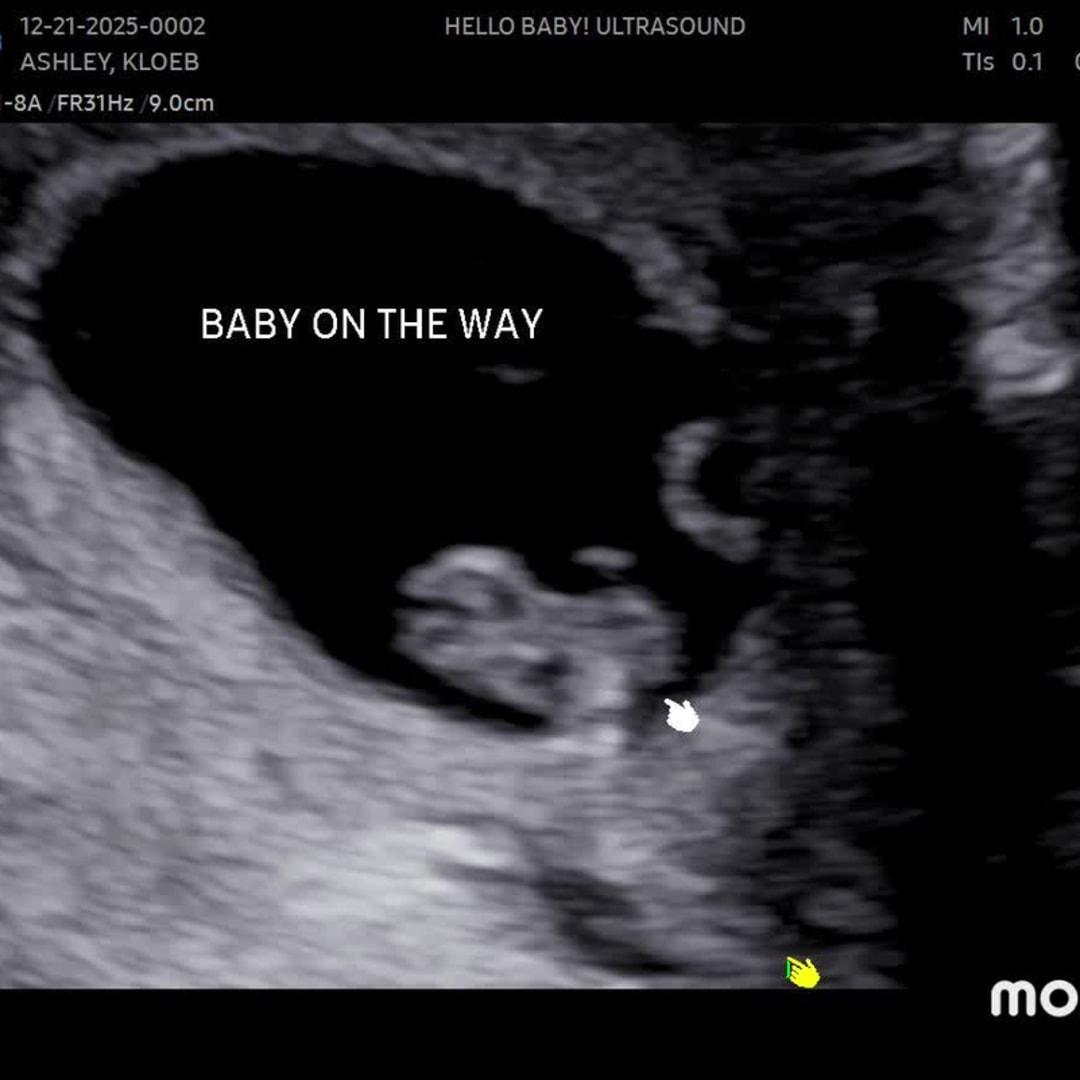 Photo shared by Ashley for their Babylist baby registry.