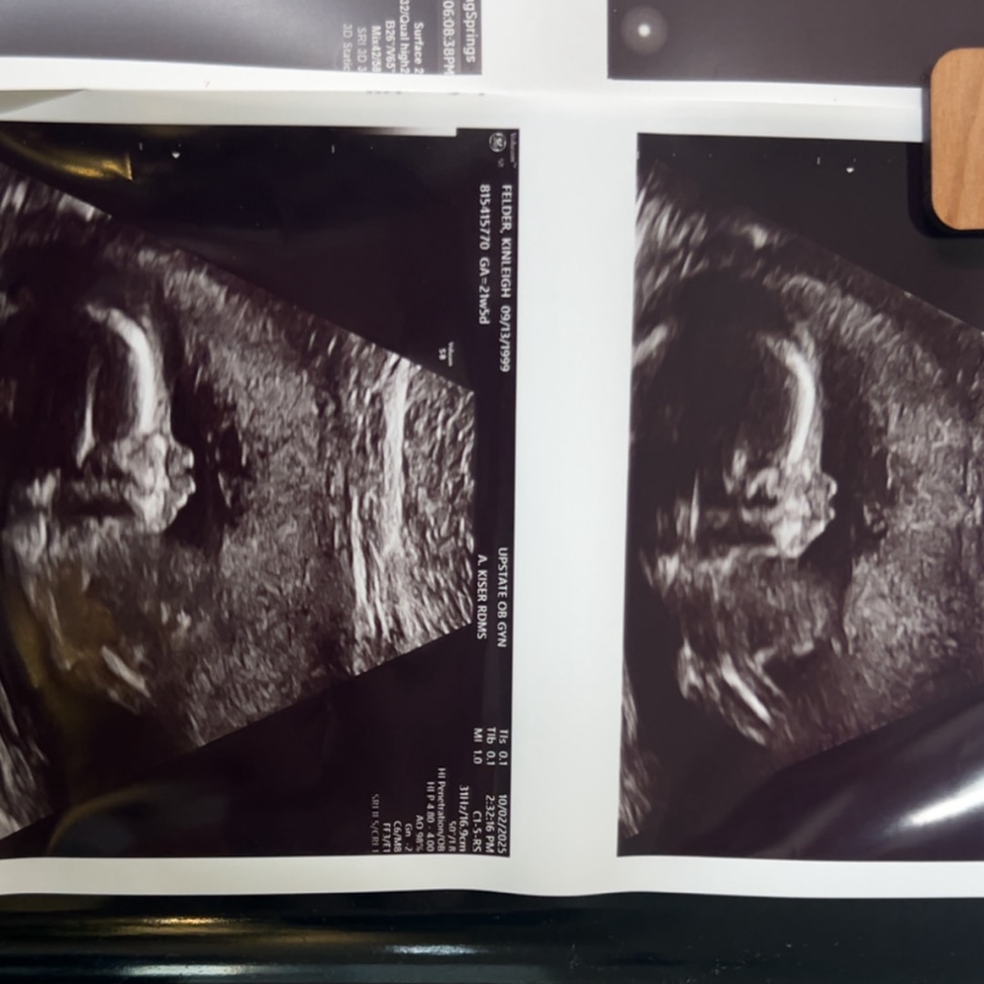 Photo shared by Kinleigh for their Babylist baby registry.