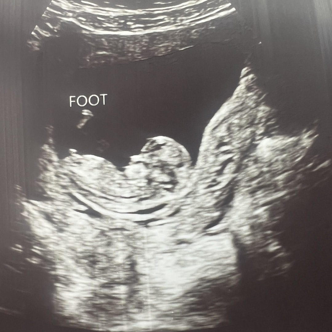 Photo shared by Mysti for their Babylist baby registry.