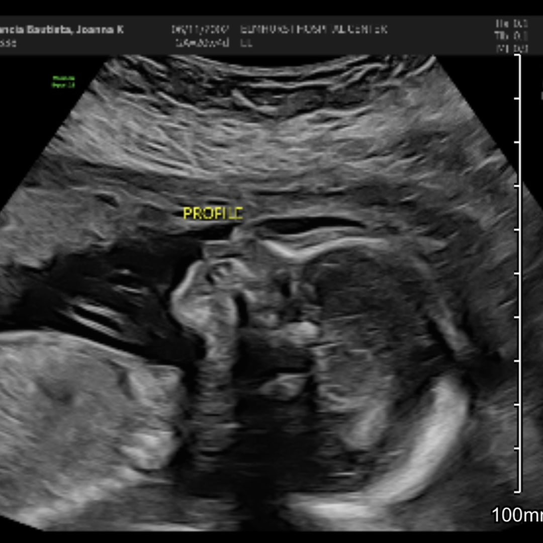 Photo shared by JOANNA KIMBERLY for their Babylist baby registry.