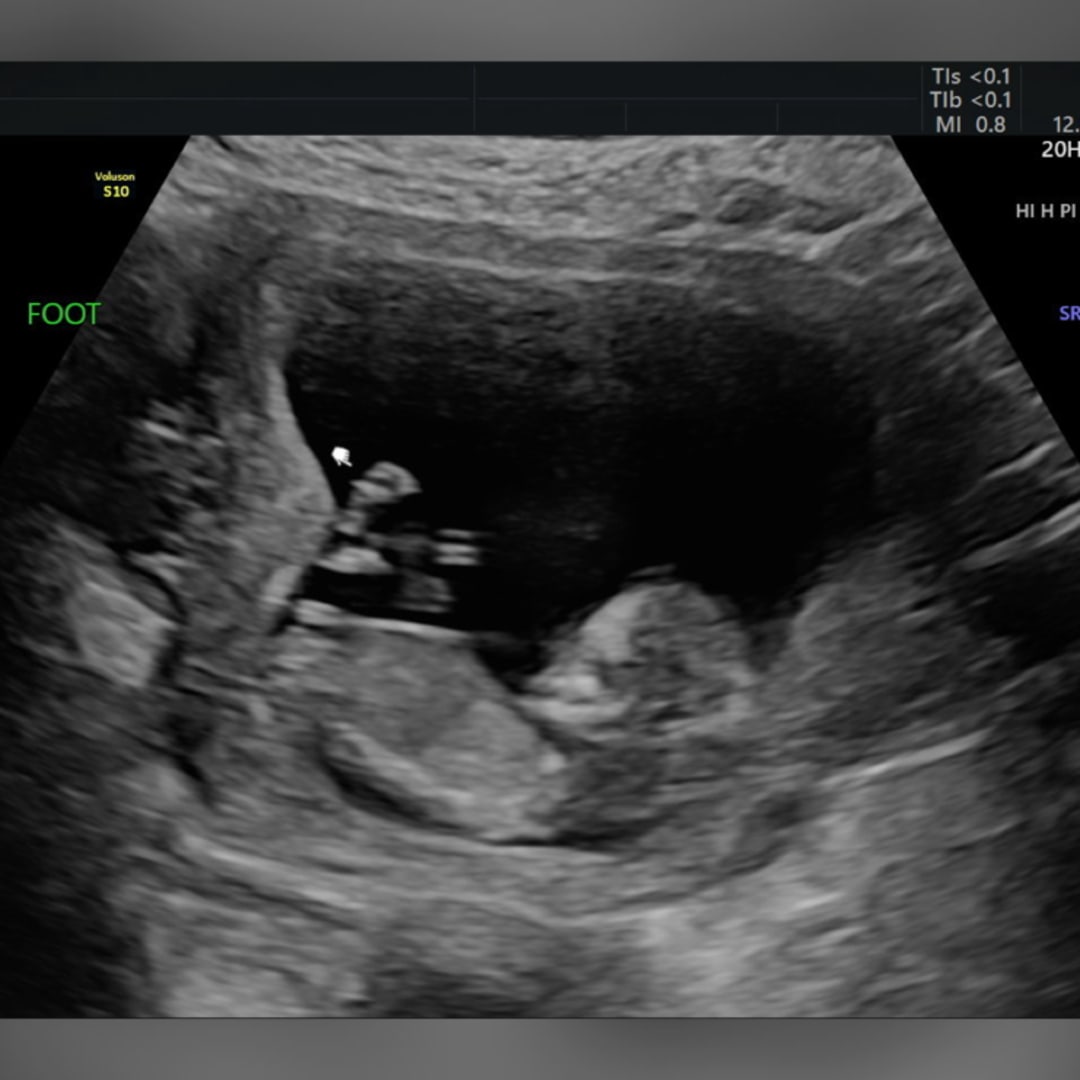 Photo shared by Leila for their Babylist baby registry.