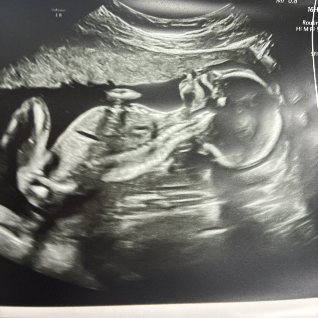 Photo shared by Q for their Babylist baby registry.